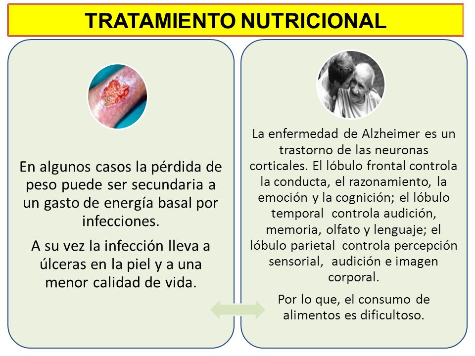 pacientes alzheimer perdida de peso